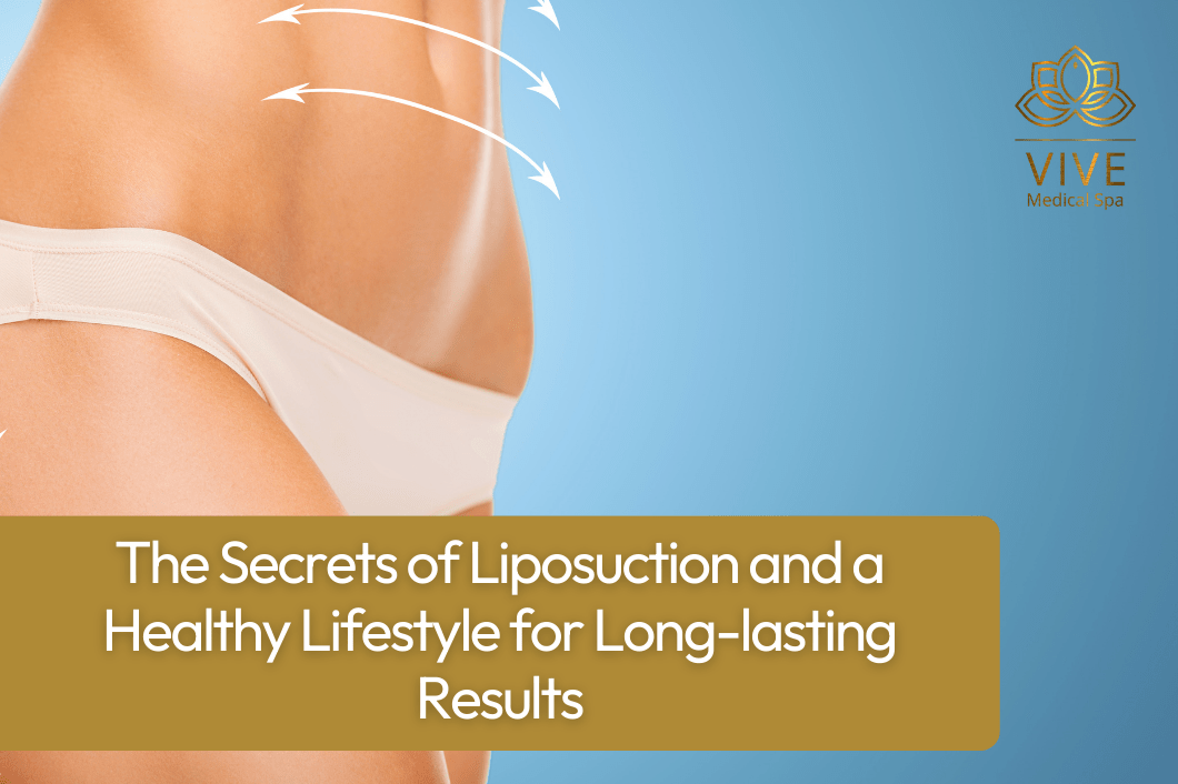 liposuction-healthy-lifestyle-long-term-results