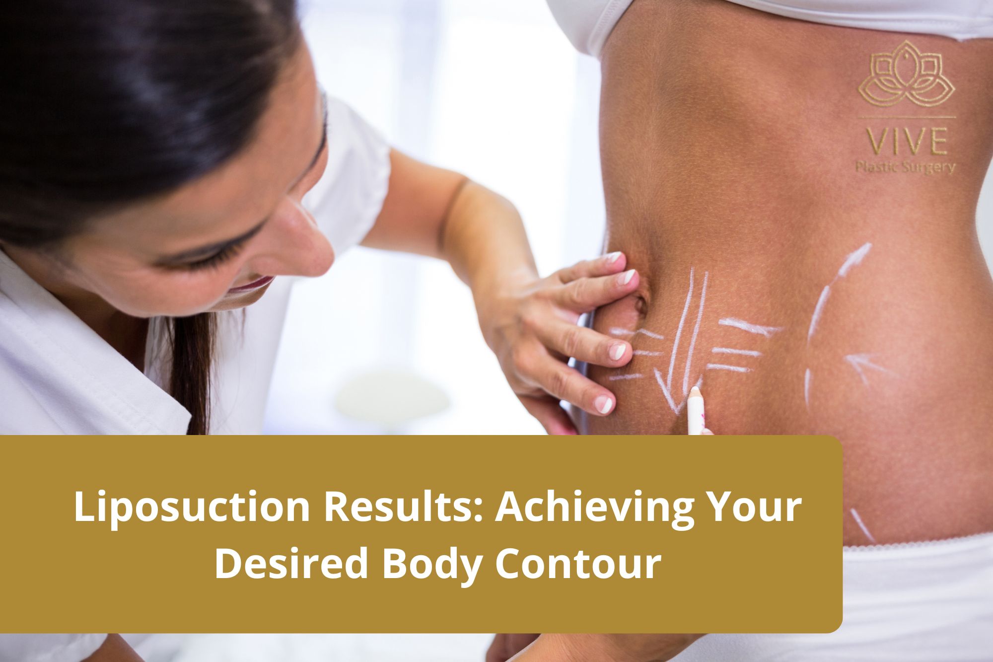 liposuction-results-achieving-your-desired-body-contour