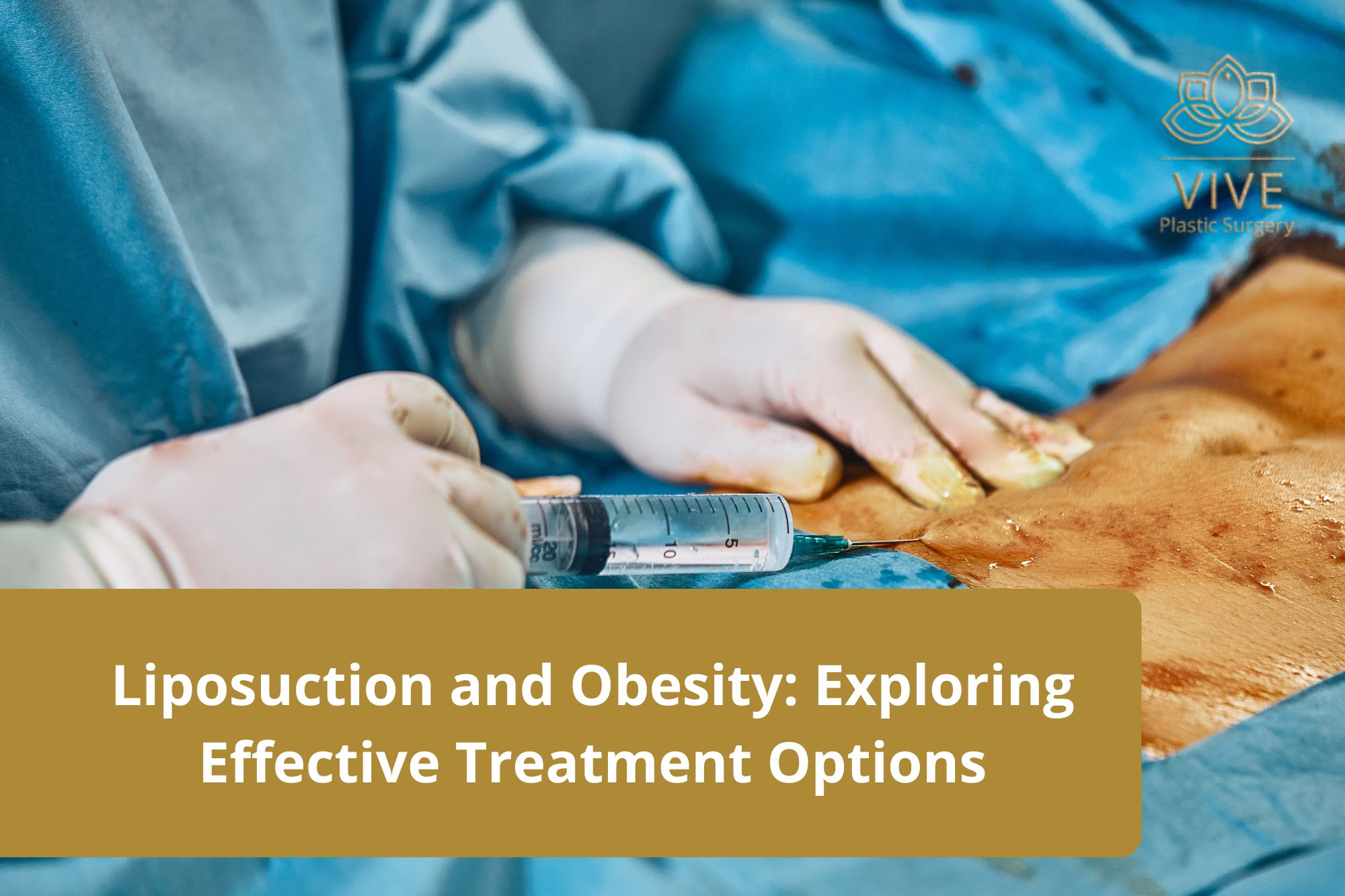 liposuction-and-obesity
