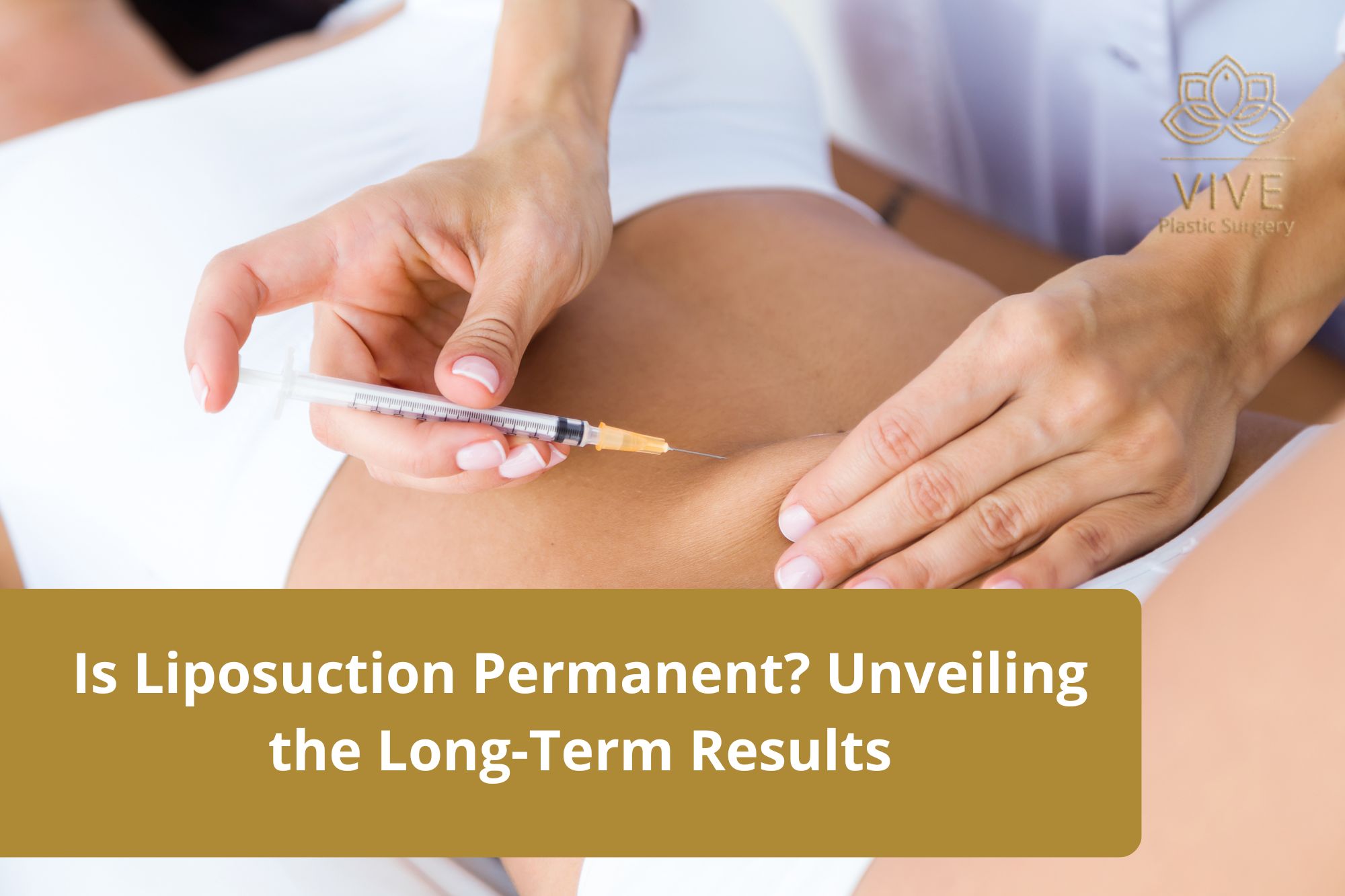 liposuction-permanent