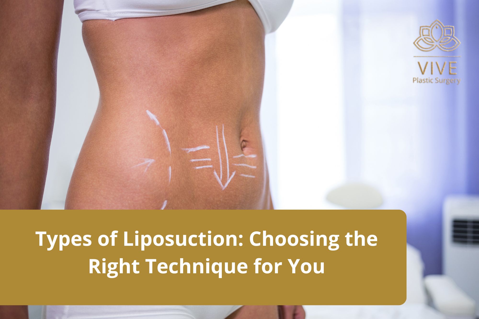 what-to-expect-from-a-facelift
