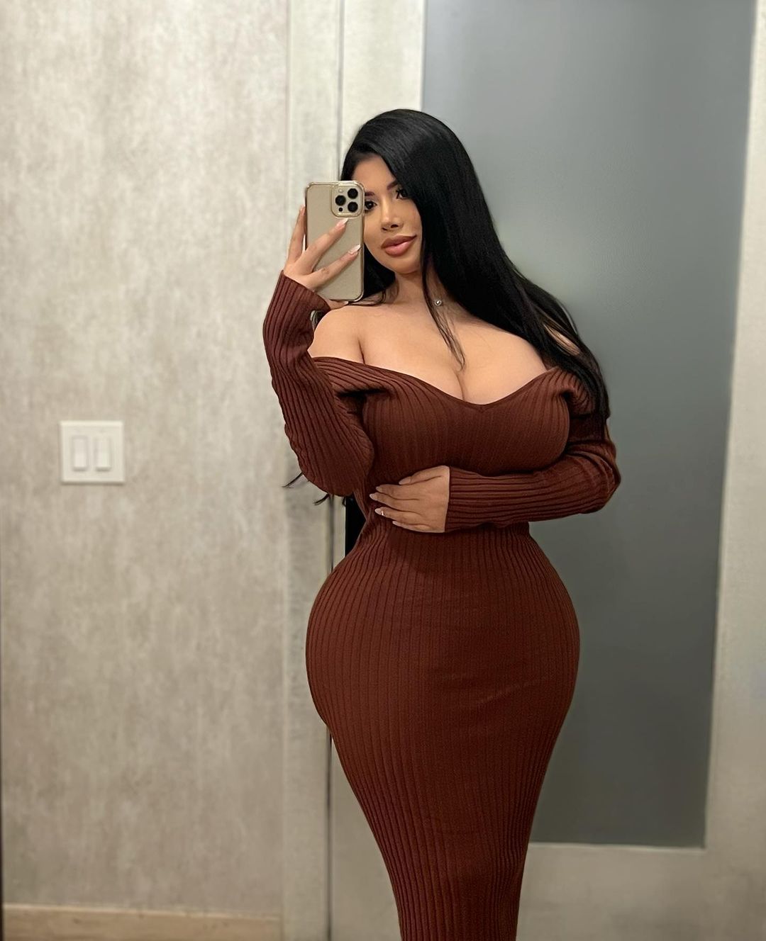 Real patient after Brazilian Butt Lift (BBL) showing enhanced hourglass shape and smooth contour at Vive Plastic Surgery Tijuana