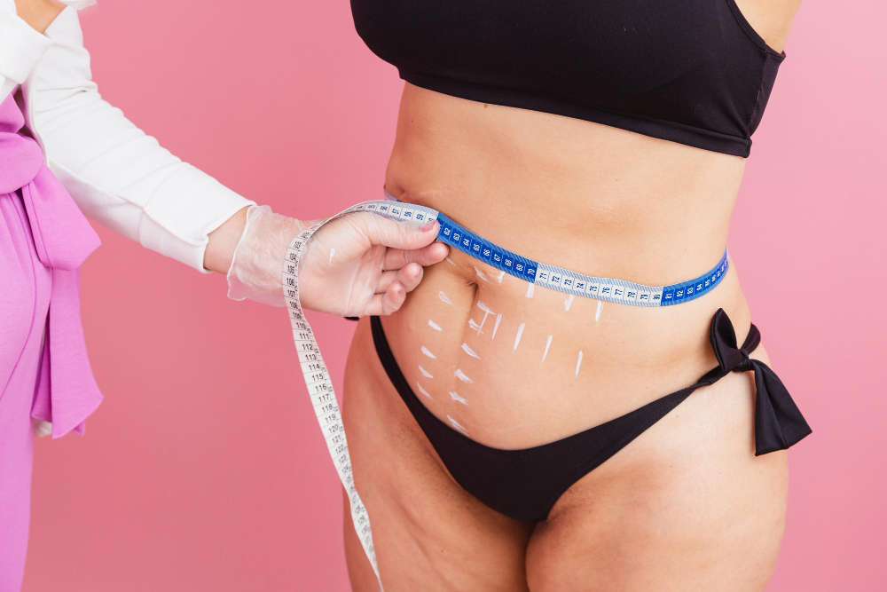 Mini Tummy Tuck vs Full Tummy Tuck: Which Is Right for You?
