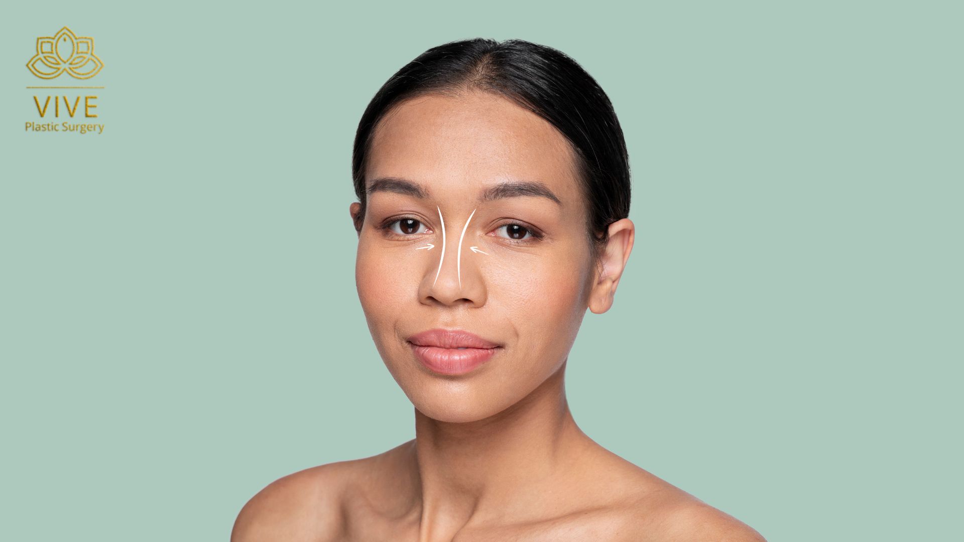 Ethnic Rhinoplasty: What to Consider