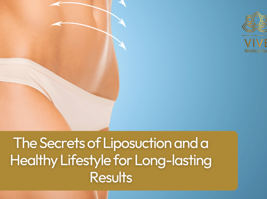 Female body after liposuction showing toned waist and hips at Vive Plastic Surgery in Tijuana