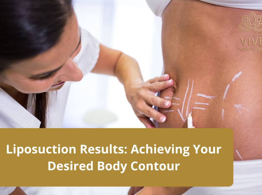 A female medical professional marking a patient's waist with white lines, outlining the targeted areas for liposuction.
