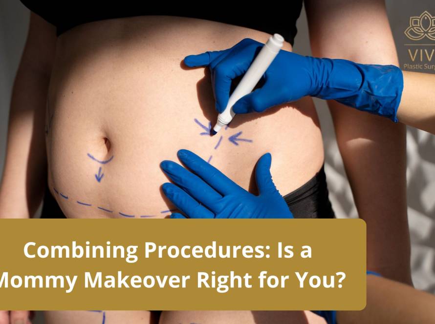 Mommy Makeover Procedure - Is It Right for You? | VIVE Plastic Surgery