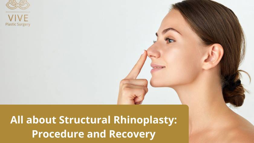 Rhinoplasty in Tijuana - Structural Nose Surgery at VIVE Plastic Surgery
