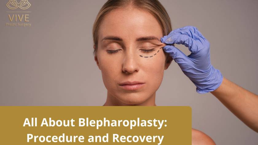 Blepharoplasty procedure at VIVE Plastic Surgery - Eyelid surgery for rejuvenation in Tijuana