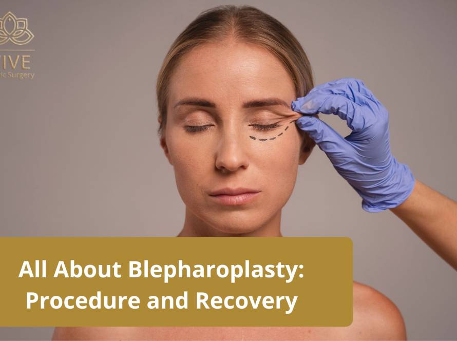Blepharoplasty procedure at VIVE Plastic Surgery - Eyelid surgery for rejuvenation in Tijuana