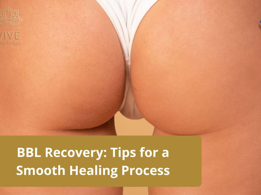 BBL recovery tips - Smooth healing process after Brazilian Butt Lift at VIVE Plastic Surgery Tijuana.