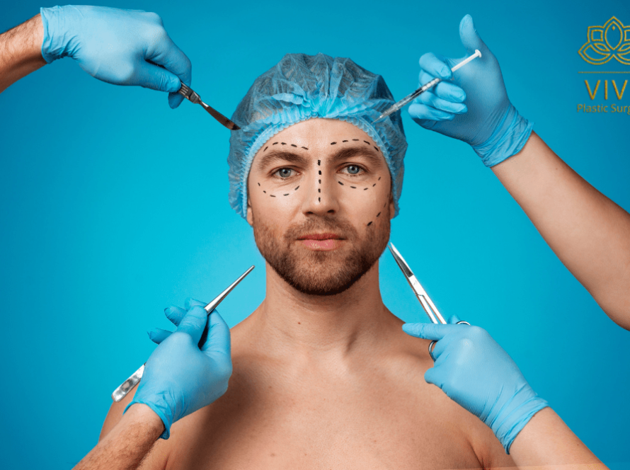 Male model with surgical markings during a facial plastic surgery consultation at VIVE Plastic Surgery in Tijuana.