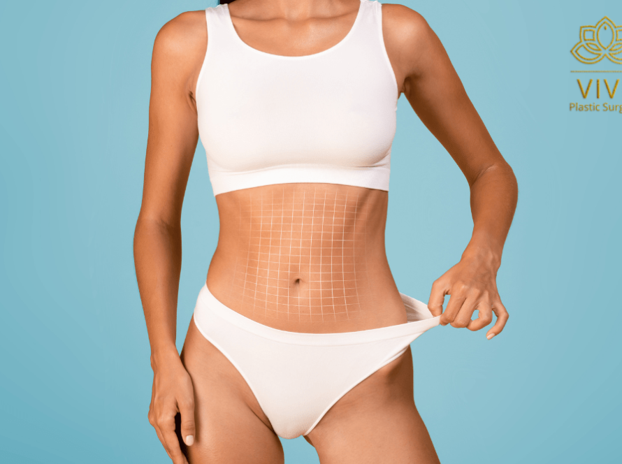 Female model showcasing abdominal sculpting and liposuction results, highlighting a flat and toned stomach achieved at VIVE Plastic Surgery in Tijuana.