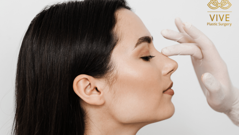 Woman profile consultation for rhinoplasty nose surgery in Tijuana