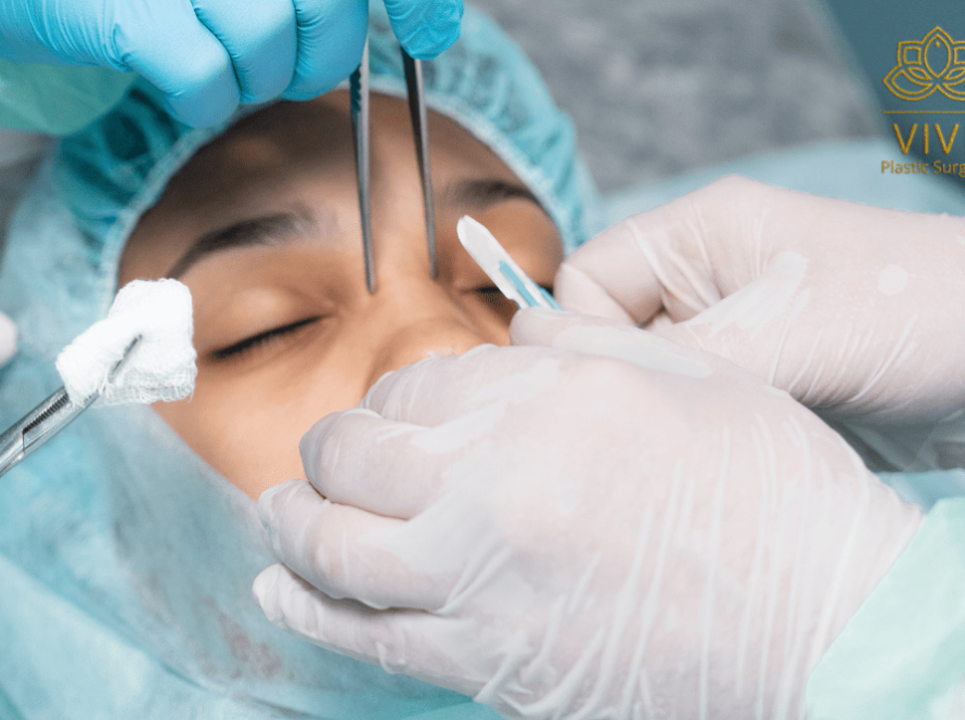 Close-up of a reconstructive rhinoplasty procedure at VIVE Plastic Surgery, specializing in Botox, lip fillers, and advanced butt fillers in Tijuana.