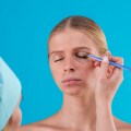 Does Eyelid Surgery Make You Look Younger?