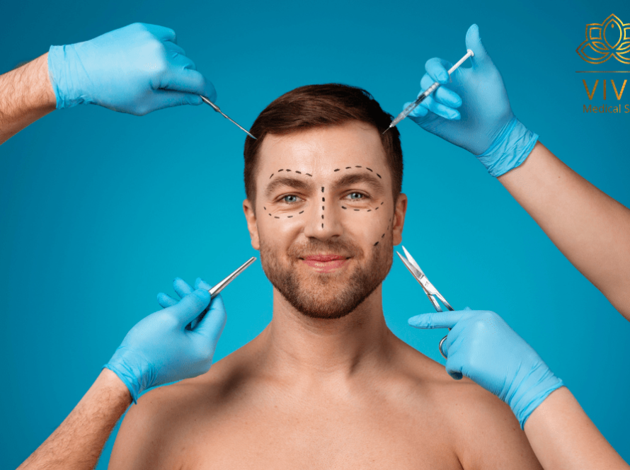 Male model with surgical markings during a facial plastic surgery consultation at VIVE Plastic Surgery in Tijuana.
