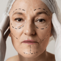 What Happens to Facial Fat With Age?