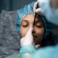 Rhinoplasty Recovery: What No One Tells You