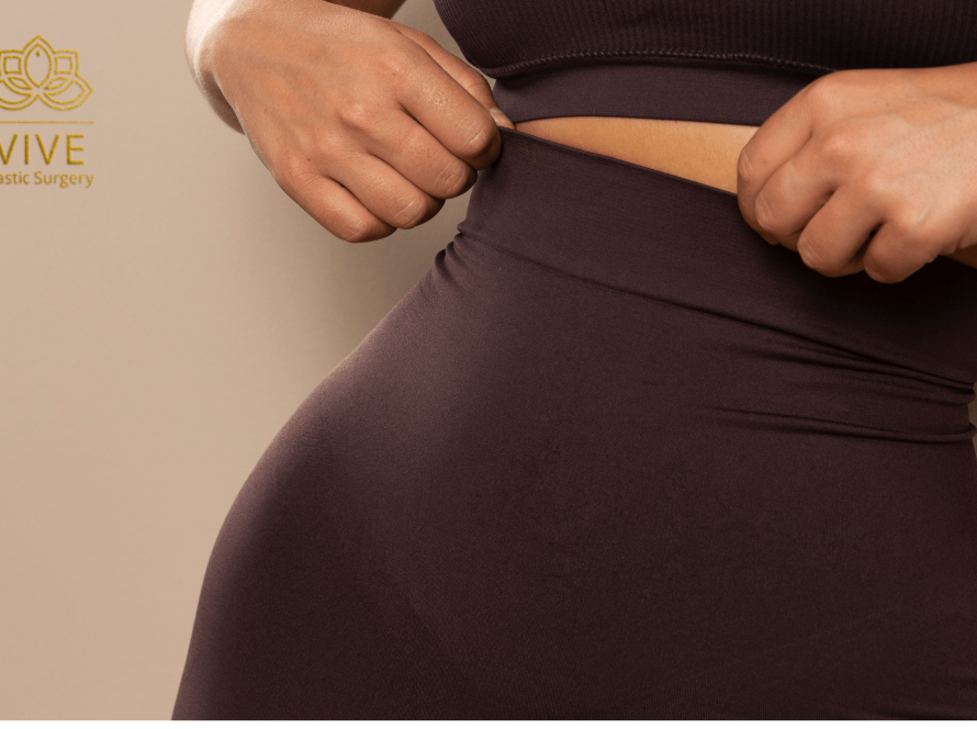 Woman body contour after Brazilian Butt Lift and Lipo 360 in Tijuana
