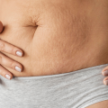 Why Skin Doesn’t Always Bounce Back After Pregnancy