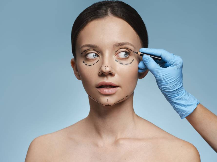 Woman with face marked before plastic surgery consultation in Tijuana