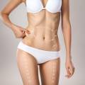 Body Contouring After Weight Loss: Options Explained