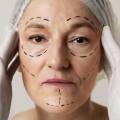 Signs You’re Ready for a Facelift