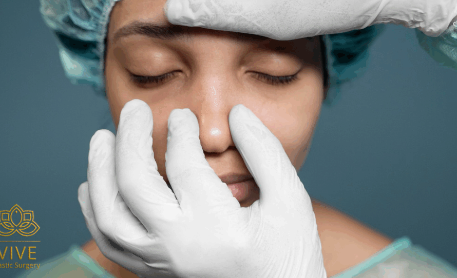 surgeon evaluating a patient’s nose before rhinoplasty at VIVE Plastic Surgery in Tijuana