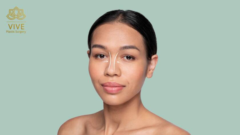 Gastric Sleeve Surgery (13) - cirugia bariatrica manga gastrica Tijuana Mexico