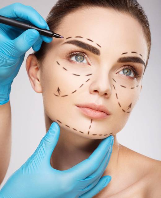 Woman with face markings before cosmetic surgery consultation in Tijuana